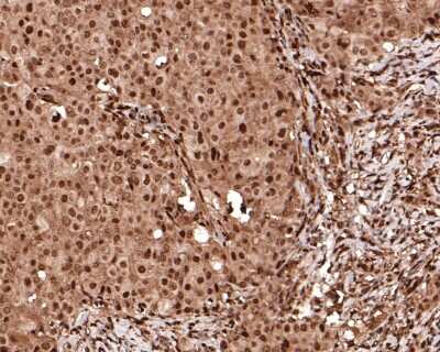 Immunohistochemistry-Paraffin: HES-1 Antibody (SC06-21) [NBP2-67642]