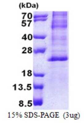 SDS-PAGE: Recombinant Human HES2 His Protein [NBP2-23099]