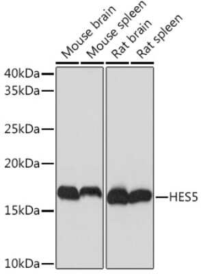 Western Blot: HES5 Antibody (4S4U7) [NBP3-16880]