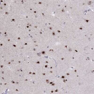 Immunohistochemistry-Paraffin: HES5 Antibody [NBP2-69014]