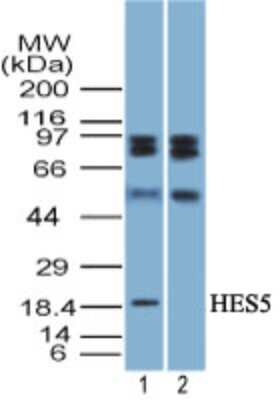 Western Blot: HES5 Antibody [NBP2-27174]