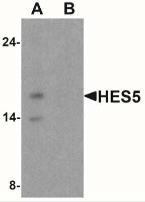 Western Blot: HES5 AntibodyBSA Free [NBP2-41305]