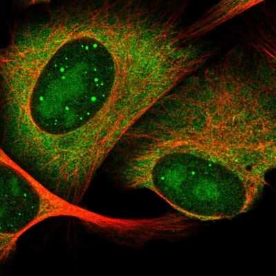 Immunocytochemistry/ Immunofluorescence: HES6 Antibody [NBP2-57558]