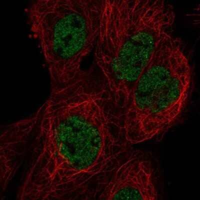Immunocytochemistry/ Immunofluorescence: HES7 Antibody [NBP2-49675]