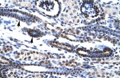 Immunohistochemistry-Paraffin: HES7 Antibody [NBP2-85042]