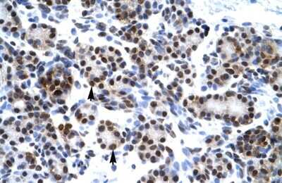 Immunohistochemistry-Paraffin: HES7 Antibody [NBP2-85042]