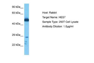 Western Blot: HES7 Antibody [NBP2-85042]