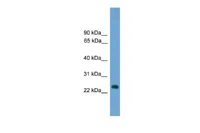 Western Blot: HES7 Antibody [NBP2-85044]
