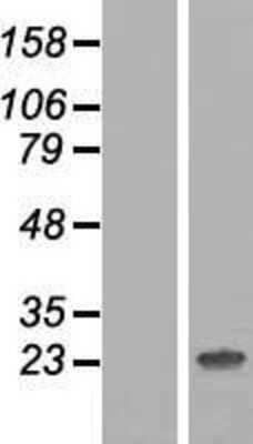 Western Blot: HES7 Overexpression Lysate [NBP2-05999]