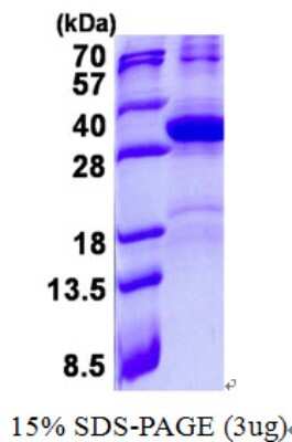 SDS-PAGE: Recombinant Human HES7 His Protein [NBP2-23100]