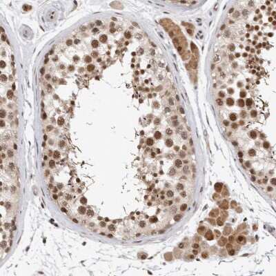 Immunohistochemistry-Paraffin: HESX1 Antibody [NBP1-89090]