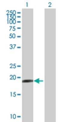 Western Blot: HESX1 Antibody [H00008820-B01P]