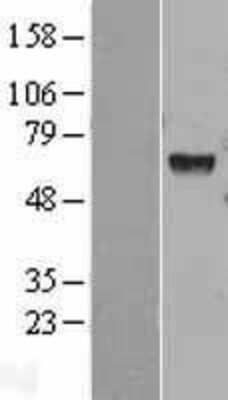 Western Blot: Hexosaminidase A/HEXA Overexpression Lysate [NBL1-11515]