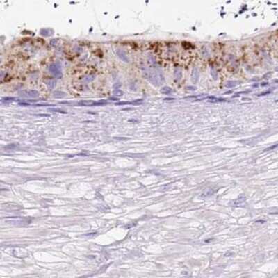 Immunohistochemistry-Paraffin: HEXB Antibody [NBP2-48689]