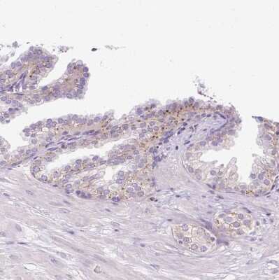 Immunohistochemistry-Paraffin: HEXB Antibody [NBP2-49211]