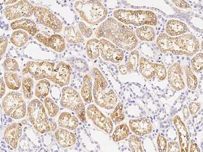 Immunohistochemistry-Paraffin: HEXB Antibody [NBP3-00084]