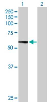 Western Blot: HEXB Antibody [H00003074-B01P]