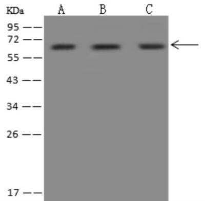 Western Blot: HEXB Antibody [NBP3-06429]