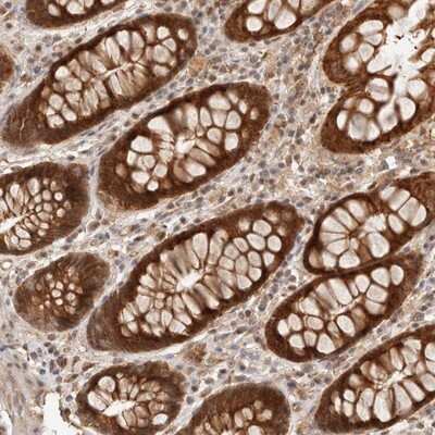 Immunohistochemistry-Paraffin: HEXDC Antibody [NBP1-83573]