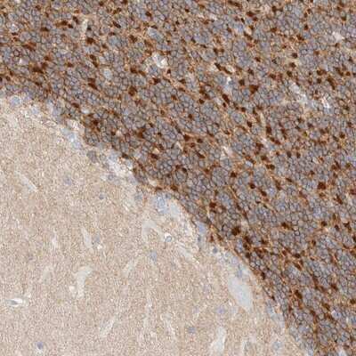 Immunohistochemistry-Paraffin: HEXDC Antibody [NBP1-83574]