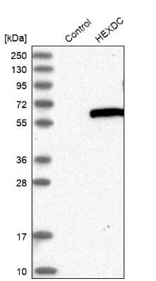 Western Blot: HEXDC Antibody [NBP1-83574]