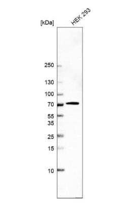 Western Blot: HEXDC Antibody [NBP1-83575]