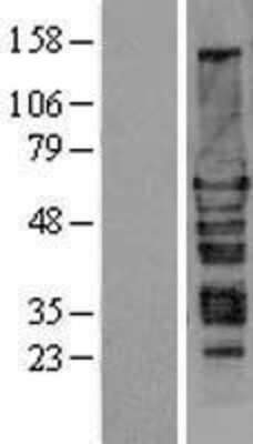 Western Blot: Hexim 1 Overexpression Lysate [NBL1-11518]