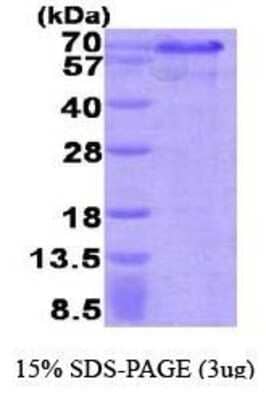 SDS-PAGE: Recombinant Human Hexim 1 His Protein [NBP1-37094]