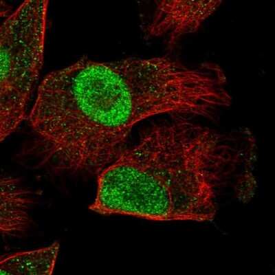 Immunocytochemistry/ Immunofluorescence: HEXIM2 Antibody [NBP1-93877]