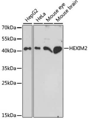 Western Blot: HEXIM2 AntibodyAzide and BSA Free [NBP3-04730]