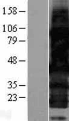 Western Blot: HEXIM2 Overexpression Lysate [NBP2-04423]