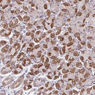 Immunohistochemistry: HEXO Antibody [NBP2-38756]