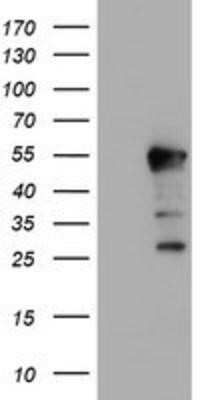 Western Blot: HEXO Antibody (OTI1B3)Azide and BSA Free [NBP2-72312]