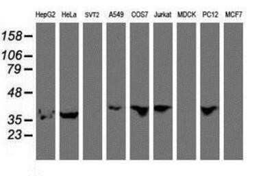 Western Blot: HEXO Antibody (OTI1B3) [NBP2-01655]