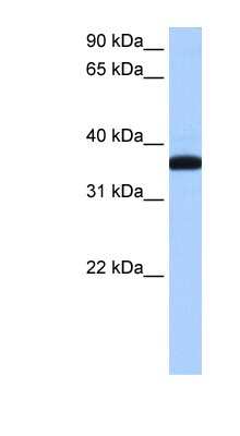 Western Blot: HEXO Antibody [NBP1-57118]