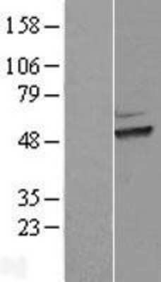 Western Blot: HEXO Overexpression Lysate [NBL1-16884]