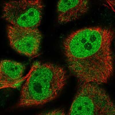 Immunocytochemistry/ Immunofluorescence: HEY1 Antibody [NBP2-56068]