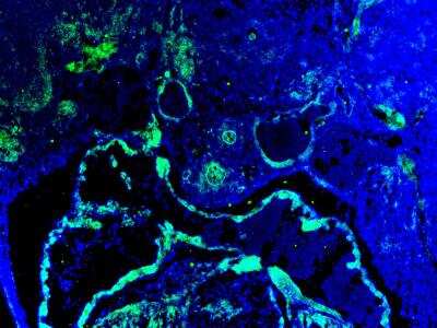 Immunohistochemistry-Frozen: HEY1 Antibody [NBP2-16818]