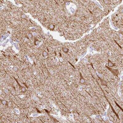 Immunohistochemistry-Paraffin: HEY1 Antibody [NBP2-47436]