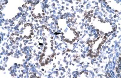 Immunohistochemistry-Paraffin: HEY1 Antibody [NBP3-10943]