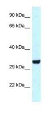 Western Blot: HEY1 Antibody [NBP1-82377]