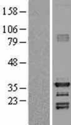 Western Blot: HEY1 Overexpression Lysate [NBL1-11520]