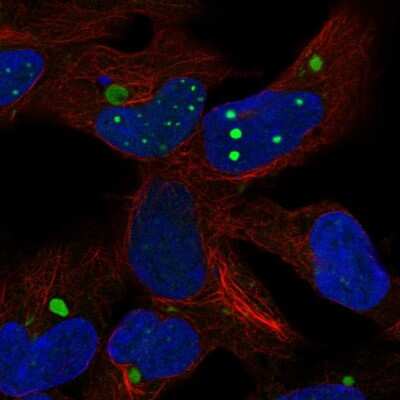 Immunocytochemistry/ Immunofluorescence: HEY2 Antibody [NBP2-57809]