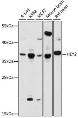 Western Blot: HEY2 AntibodyAzide and BSA Free [NBP3-03905]