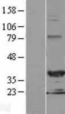 Western Blot: HEY2 Overexpression Lysate [NBL1-11522]