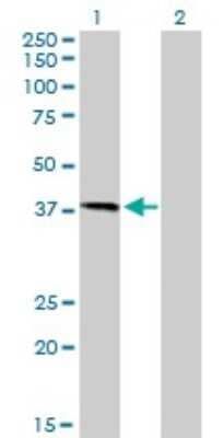 Western Blot: HFE Antibody (1G12) [H00003077-M01]