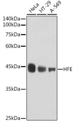 Western Blot: HFE Antibody (2O7D2) [NBP3-15323]