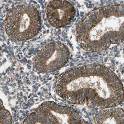 Immunohistochemistry: HFE Antibody [NBP1-83250]