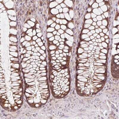 Immunohistochemistry: HFE Antibody [NBP2-38702]
