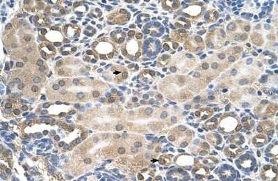Immunohistochemistry-Paraffin: HFE Antibody [NBP1-59055]